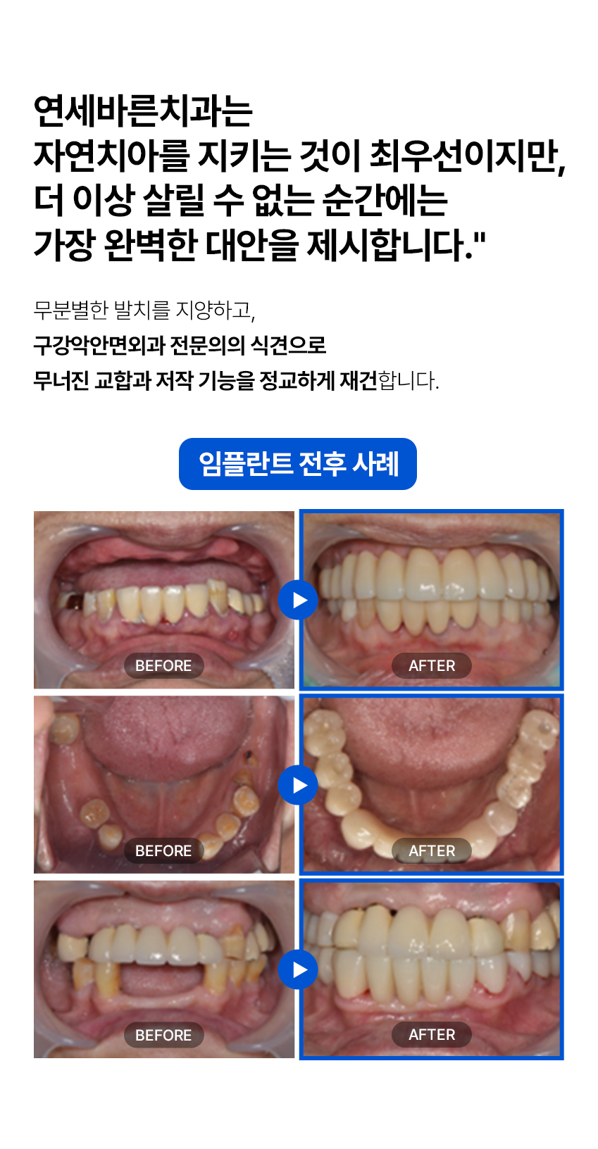 이미지명