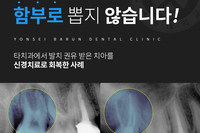 범계치과 치아를 함부로 뽑지 않습니다.