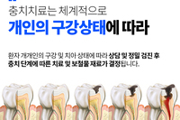 안양충치 치료,레진 수복 과정 및 주의사항