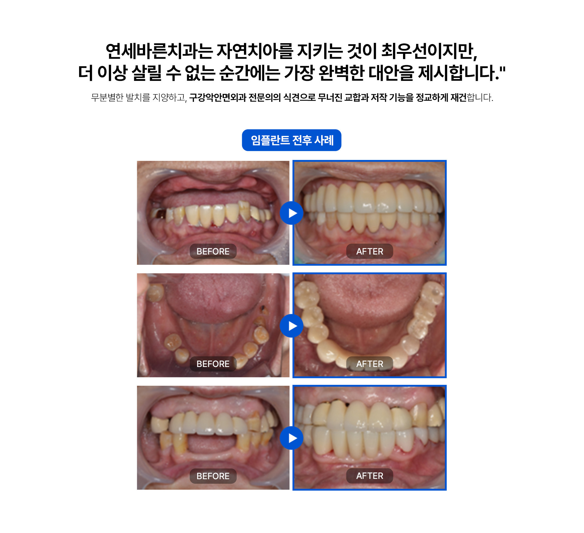 이미지명