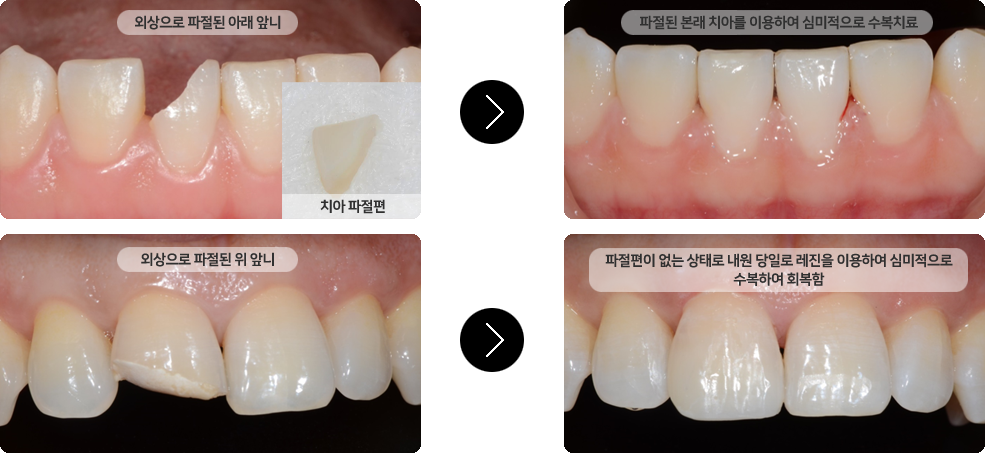 이미지명