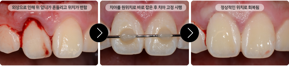 이미지명