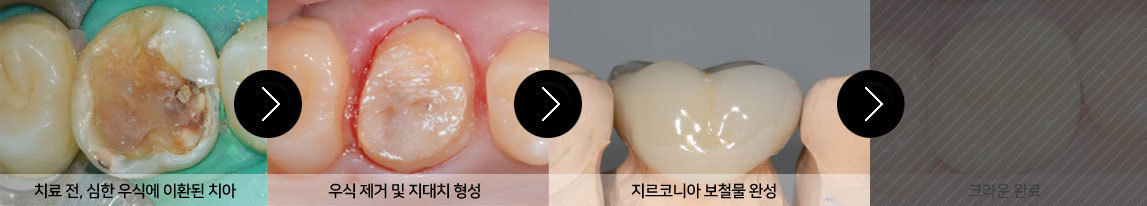 이미지명