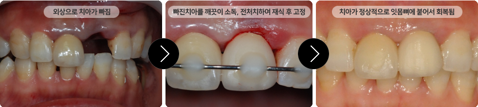 이미지명