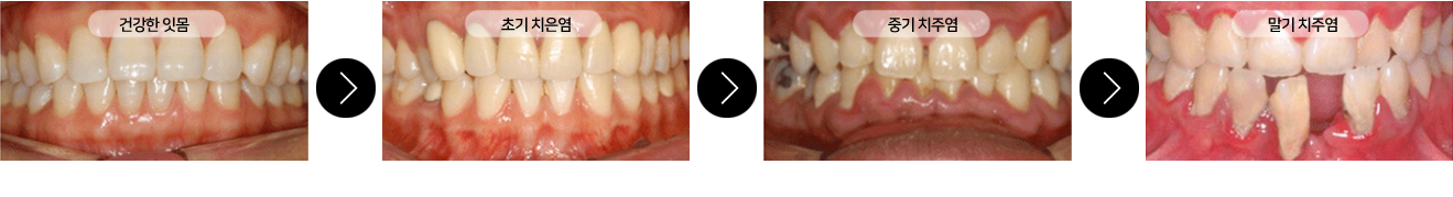 이미지명