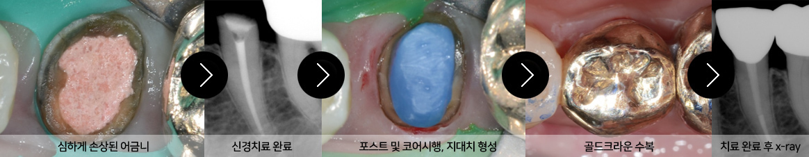이미지명